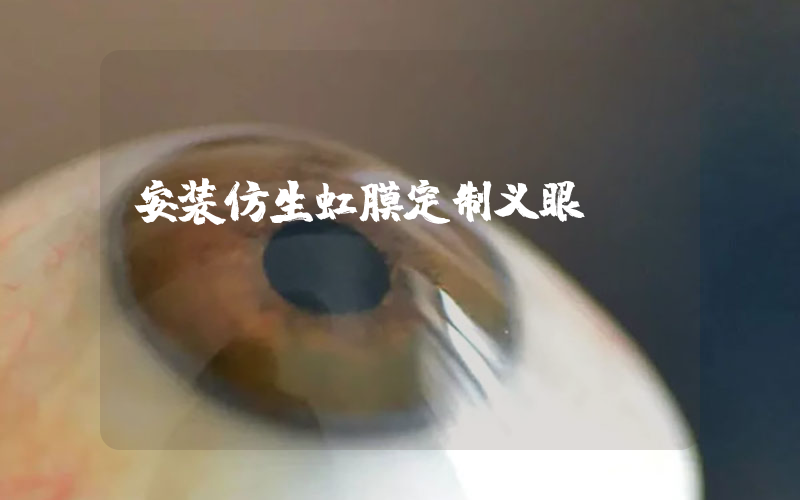 安装仿生虹膜定制义眼