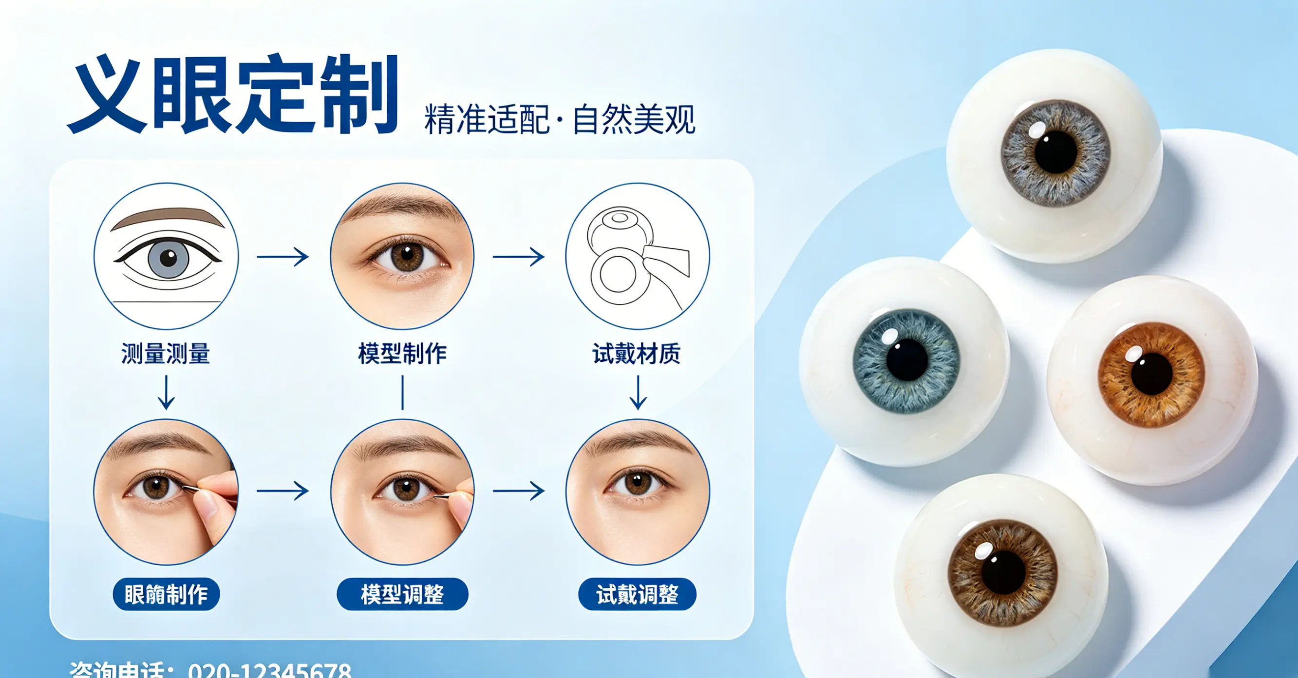 2026年义眼片佩戴歪斜调整指南：从原因分析到专业修复解决方案
