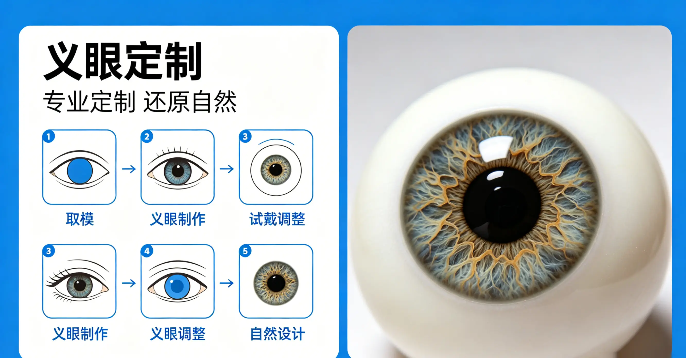 2026年杭州定制超薄仿真义眼医院与专家选择指南