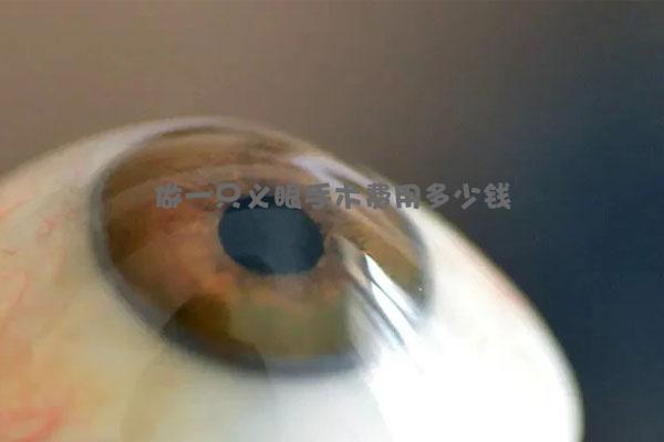 做一只义眼手术费用多少钱