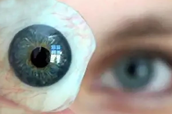 做完眼球手术需要放义眼吗